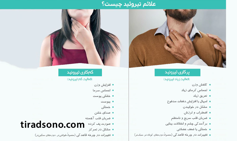 سایر علائم بیماری تیروئید