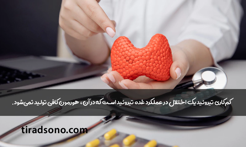 کمکاری تیروئید