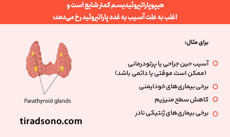 هیپوپاراتیروئیدیسم