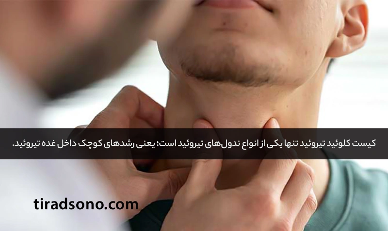 کیست کلوئید تیروئید و سایر ندول‌ها