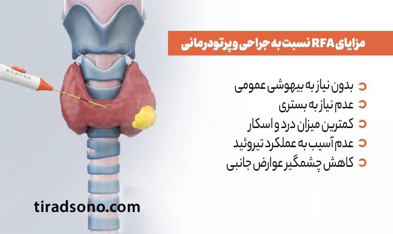 مزایای RFA نسبت به جراحی و پرتودرمانی