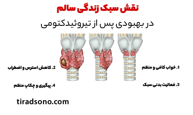 نقش سبک زندگی سالم در بهبودی پس از تیروئیدکتومی