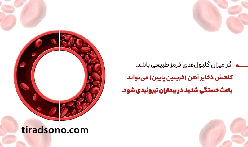 کمبود آهن بدون کم‌خونی