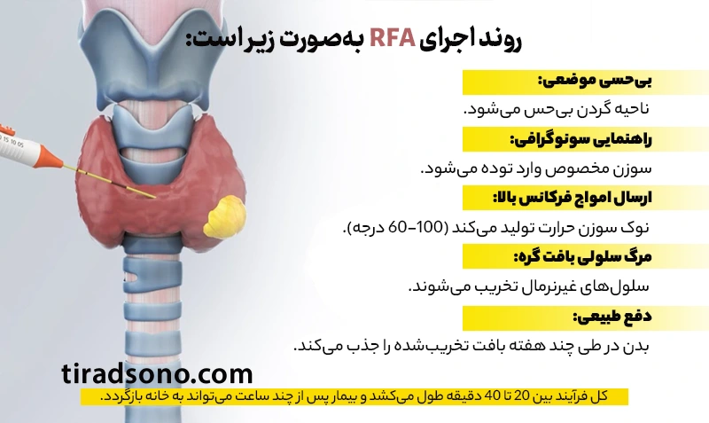 RFA دقیقاً چگونه عمل میکند؟