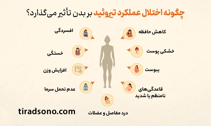اختلال عملکرد تیروئید