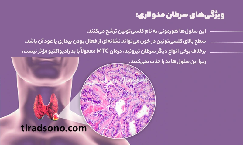 ویژگی‌های سرطان مدولاری: