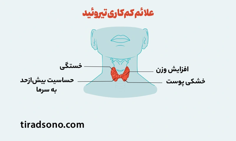 علائم کم‌کاری تیروئید