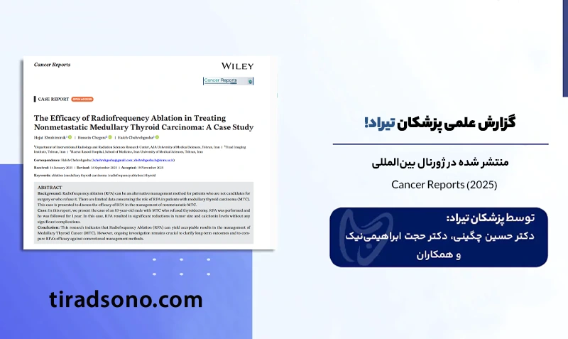 درمان نوین سرطان مدولاری تیروئید با RFA
