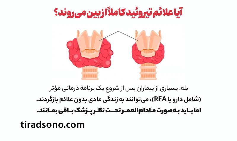 آیا علائم تیروئید کاملاً از بین میروند؟