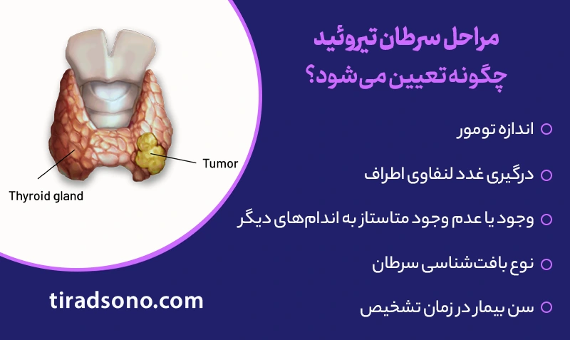 مراحل سرطان تیروئید