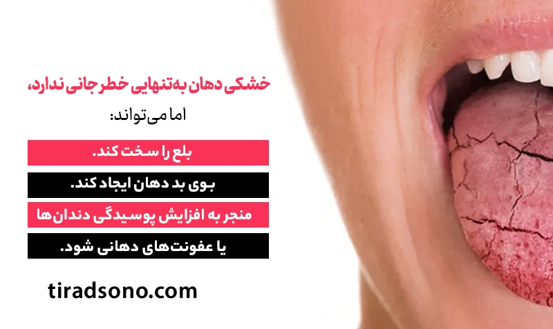 خشکی دهان (Xerostomia) در بیماران تیروئیدی
