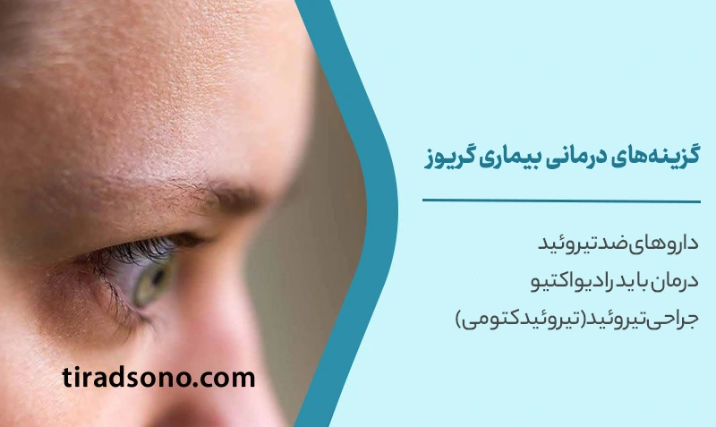گزینههای درمانی بیماری گریوز
