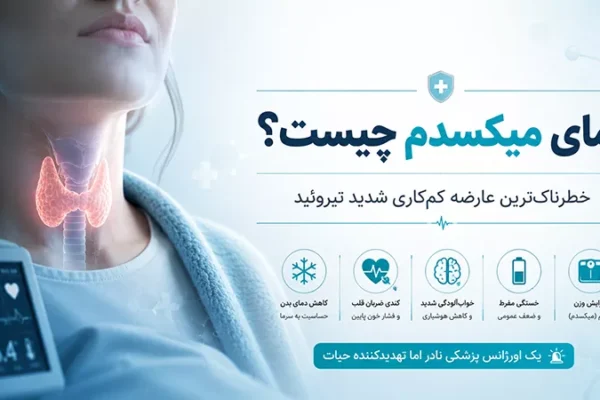 کمای میکسدم چیست