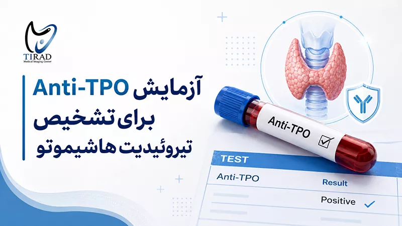 آزمایش Anti-TPO برای تشخیص تیروئیدیت هاشیموتو