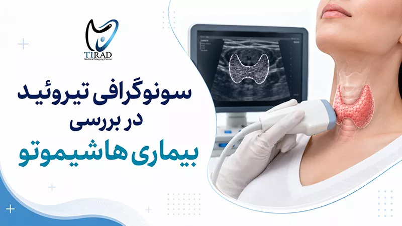 سونوگرافی تیروئید در بررسی بیماری هاشیموتو