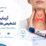 آزمایشهای تشخیص هاشیموتو