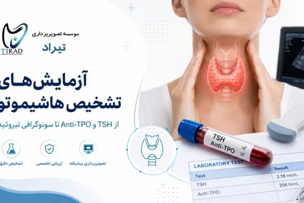 آزمایشهای تشخیص هاشیموتو