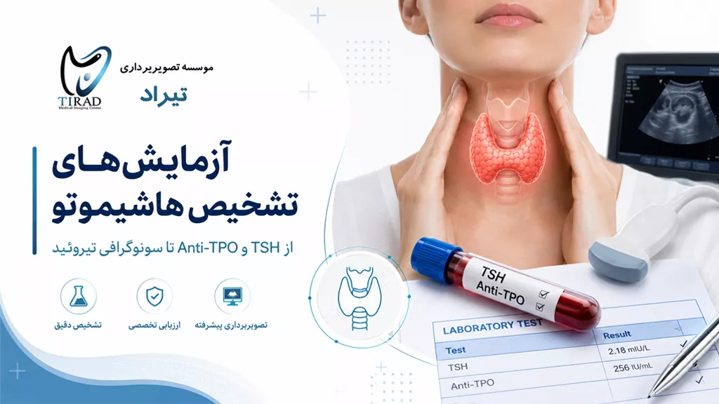 آزمایشهای تشخیص هاشیموتو