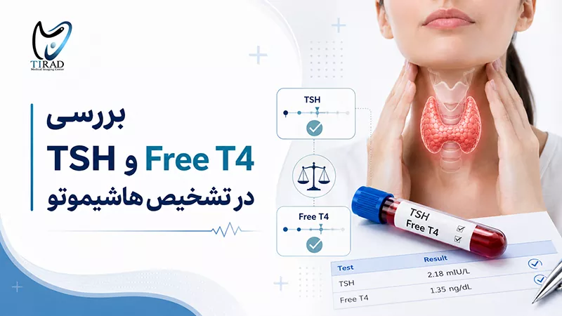 بررسی TSH و Free T4 در تشخیص هاشیموتو